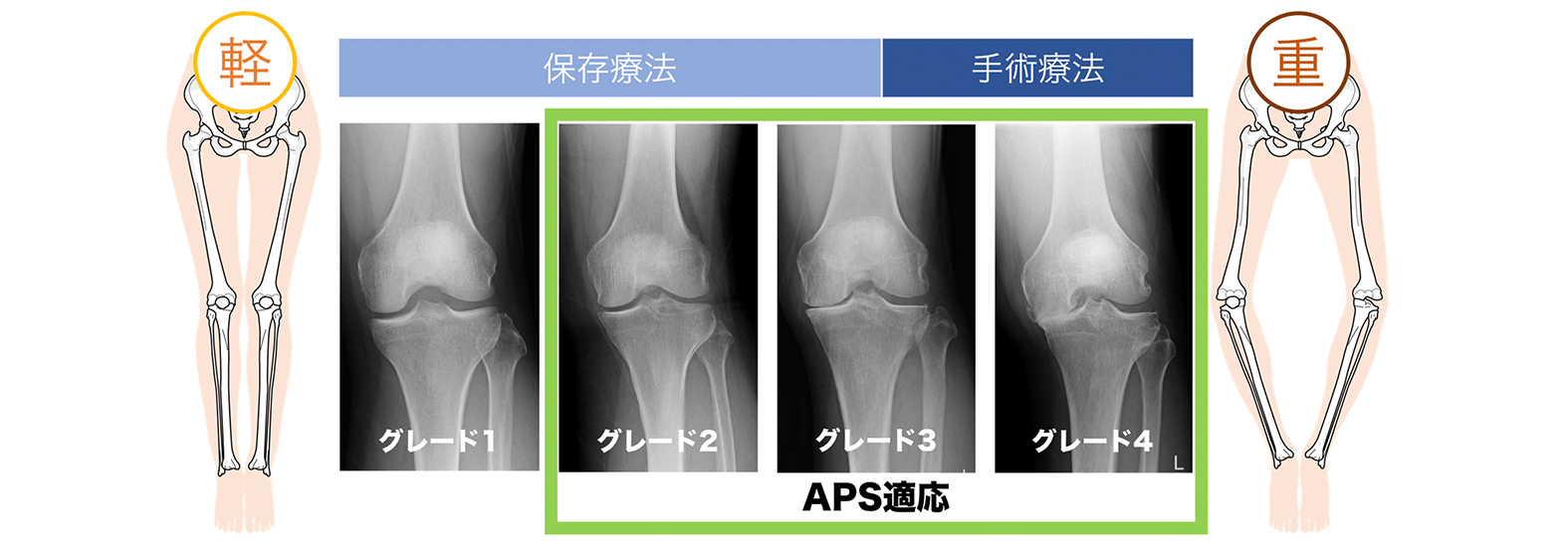 対象となる主な症状