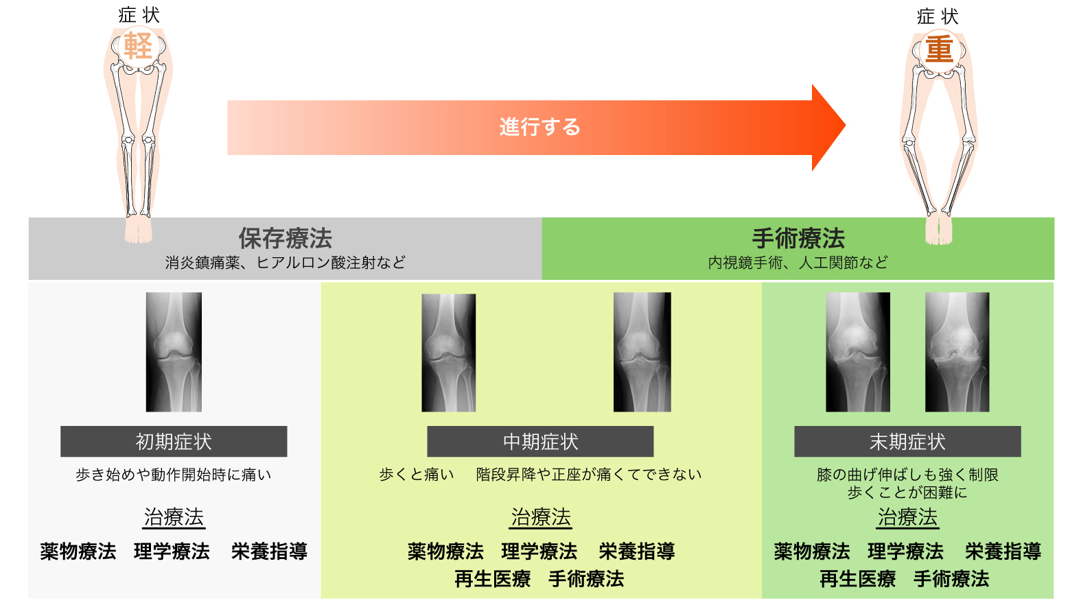 保存療法から手術療法までの症状