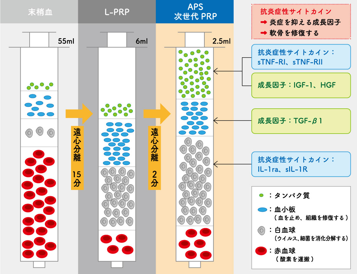 写真：APS実験的治療について